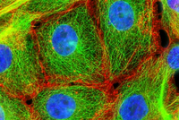 КАК ФОРМИРУЕТСЯ РАК?