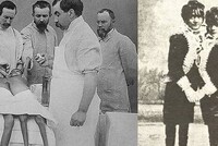 9 ФЕВРАЛЯ 1902 ГОДА: ДЕНЬ, КОГДА ДОКТОР ДУАЙЕН РАЗДЕЛИЛ СЕСТЕР – СИАМСКИХ БЛИЗНЕЦОВ