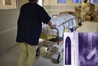 БОЕВАЯ ТРЕВОГА В АНГЛИЙСКОМ ГОСПИТАЛЕ: В ПРЯМОЙ КИШКЕ У ПАЦИЕНТА ОКАЗАЛСЯ… БОЕВОЙ СНАРЯД