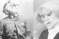 11 АПРЕЛЯ 1890 ГОДА: ДЕНЬ, КОГДА «ЧЕЛОВЕК-СЛОН» УМЕР ВО СНЕ