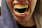 Житель Новочебоксарска осужден за укус полицейского