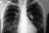 Утвержден перечень заболеваний для выхода из СИЗО