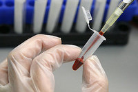 Имеет ли работодатель право знать всё о ваших болезнях?