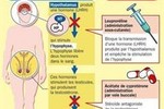 Химическая кастрация дала педофилу свободу