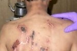 Расследование ООН: в афганских тюрьмах практикуются систематические пытки